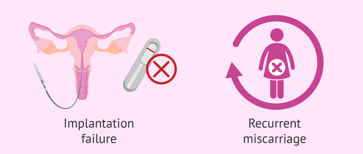 Recurrent miscarriage