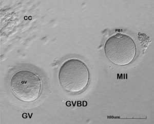 Oocyte Maturation for IVF