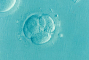 Infertility in Women and Men